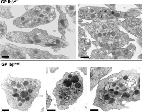 Transmission electron microscopy of purified platelets. Platelet-rich... | Download Scientific ...