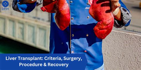 Liver Transplant: Criteria, Surgery, Procedure & Recovery - bttn