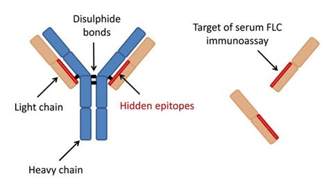 8 Types of Multiple Myeloma – Page 5 – New Life Ticket