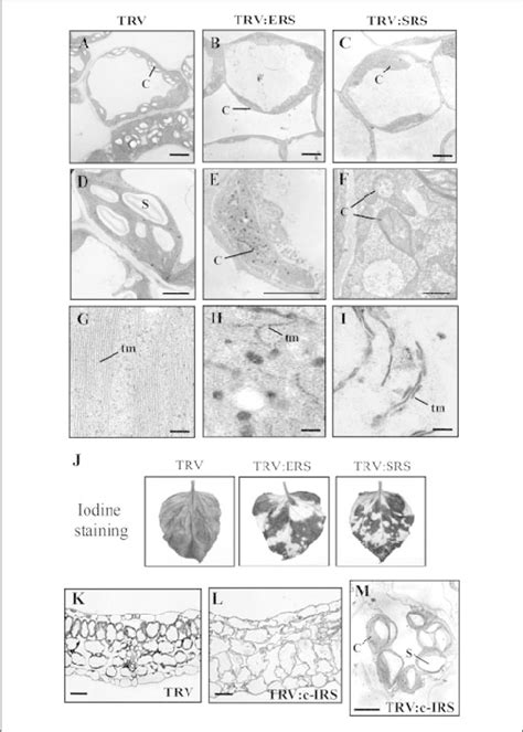 Ultrastructural analysis of mesophyll cell chloroplasts and ...