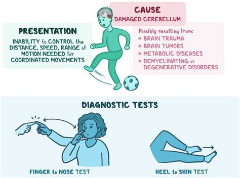 Treatment for Ataxia - MEDizzy