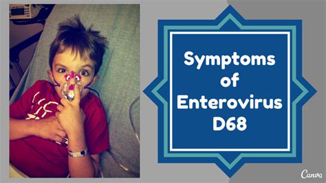 Symptoms of enterovirus D86 to watch for in kids - Alltop Viral