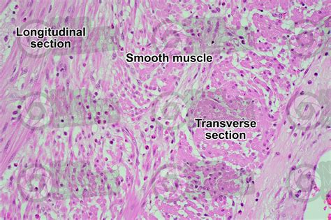 Mammal. Smooth muscle. Transverse section. 125X - Smooth muscle ...