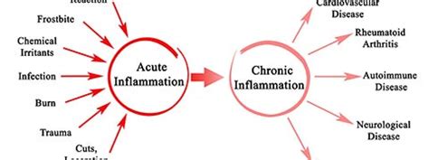 Inflammation: Types, Causes, Symptoms And Treatment