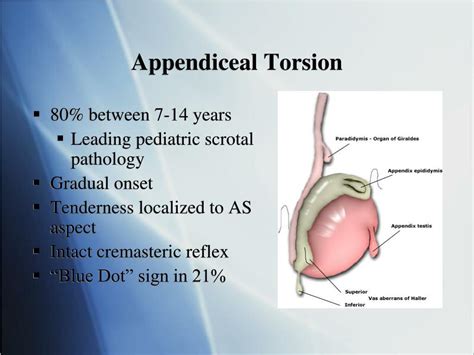 Testicular Appendage Torsion Ultrasound