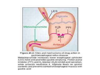 Antacids | PPT