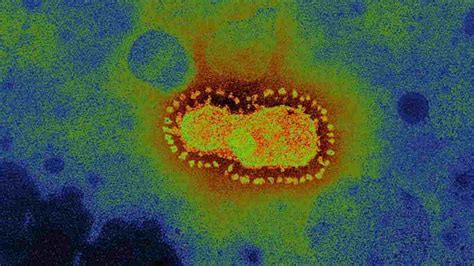 Wujud Asli Virus Corona, dari Bentuk Mahkota Hingga Serupa Parasit ...