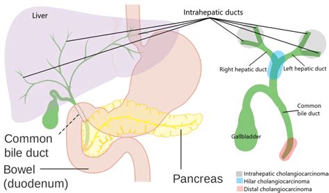 Bile Duct Cancer: Staging, Treatment and Surgery | Dr. Nikhil Agrawal