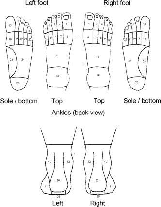 Top Foot Pain Diagnosis Chart - Best Picture Of Chart Anyimage.Org