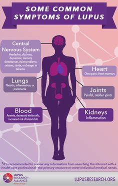 Lupus Infographics