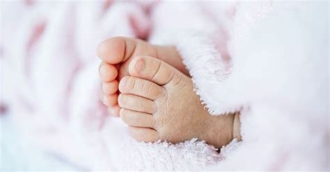 Club Foot | Causes Treatments Diagnosis | Optimists Healthcare India