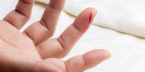 4 Most Common Workplace Injuries | Accident Treatment Centers