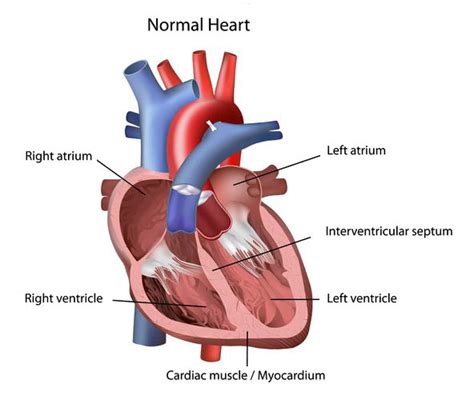 HOCM Hypertrophic Obstructive Cardiomyopathy - Cardiology - Highland ...