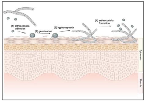 Pathogens | Free Full-Text | Current Topics in Dermatophyte Classification and Clinical Diagnosis