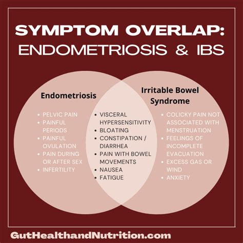 Endometriosis and IBS: Connecting the Dots - Gut Health And Nutrition