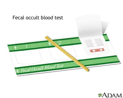 Fecal occult blood test: MedlinePlus Medical Encyclopedia Image