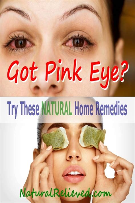 Natural Pink Eye Remedy To Keep It From Spreading - NaturalRelieved