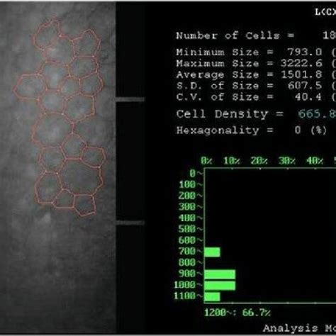 A. Specular microscopy at presentation. | Download Scientific Diagram