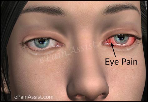 Pin on General Eye Pics