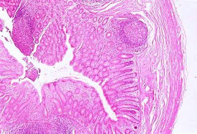 Appendix Histology - Appendix - histology slide