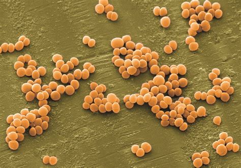 Staphylococcus aureus – Să crești mare, odoraș!