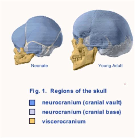 Craniofacial Abnormalities Flashcards | Quizlet