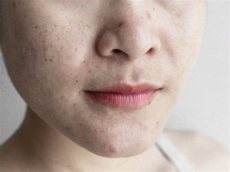 What is sebum? Function, production, benefits, and more