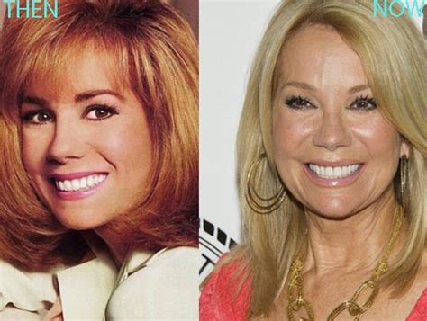 Kathie Lee Gifford Plastic Surgery Before And After Photos - CelebLens.Com