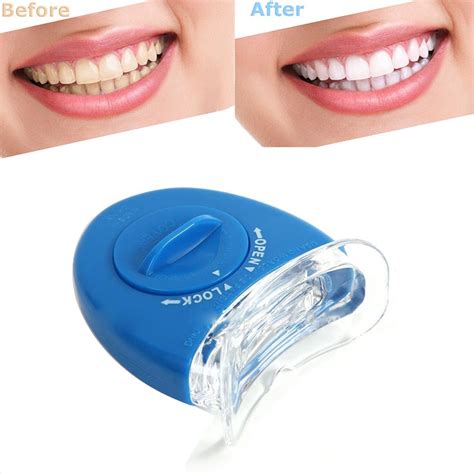 Teeth Treat: Best teeth whitening led kits