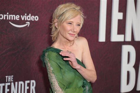 Anne Heche hospitalized with severe burns after crashing car into a ...