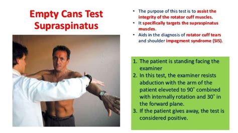 02. shoulder examination