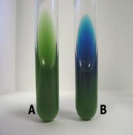 Citrate utilization Test | Medical Laboratories