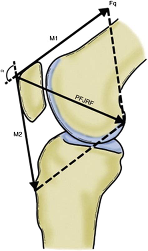 Patellofemoral Anatomy and Biomechanics - Clinics in Sports Medicine