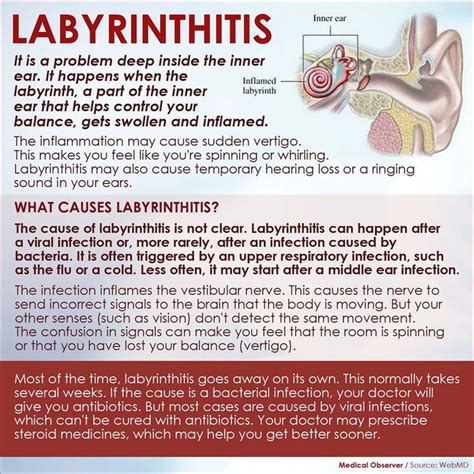 labyrinthitis | Chronic migraines, Inner ear disorders, Vertigo