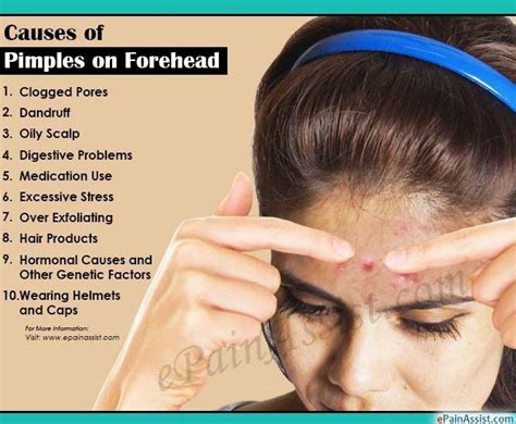 Causes of Pimples on Forehead #PimplesUnderTheSkin #PimplesExtraction # ...