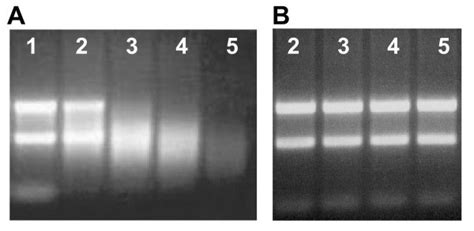 Agarose gel electrophoresis of human ribosomal RNA (100 mg/L) vortexed... | Download Scientific ...