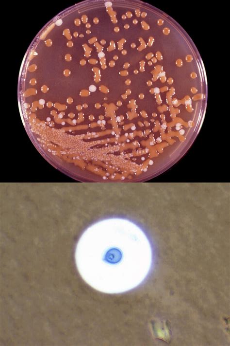 Cryptococcus | Mycology | University of Adelaide