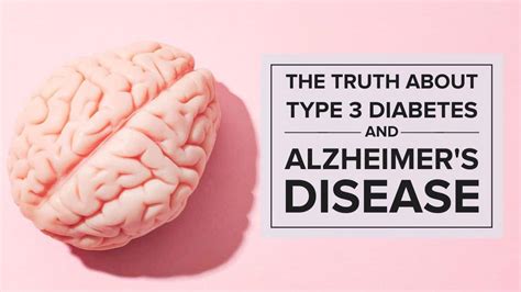 The Truth About Type 3 Diabetes and Alzheimer's Disease