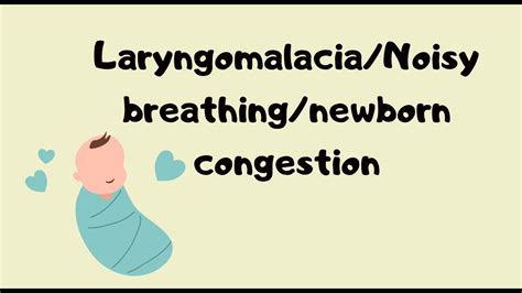 Laryngomalacia Diagram