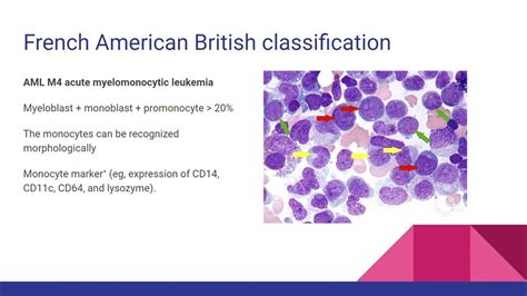 Hematologic malignancy for medical student - YouTube