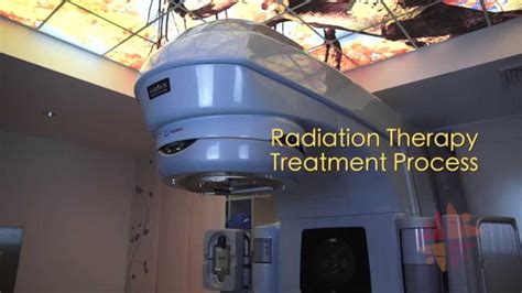 External Radiation Therapy Steps - All About Radiation