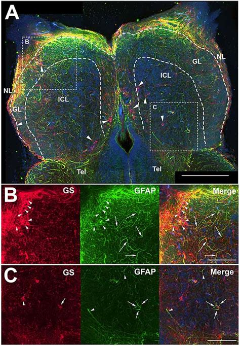 Frontiers | Zebrafish Astroglial Morphology in the Olfactory Bulb Is Altered With Repetitive ...