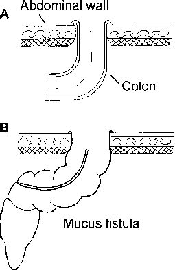 Procedure - Gastrointestinal Surgery - AmeriCorps Health