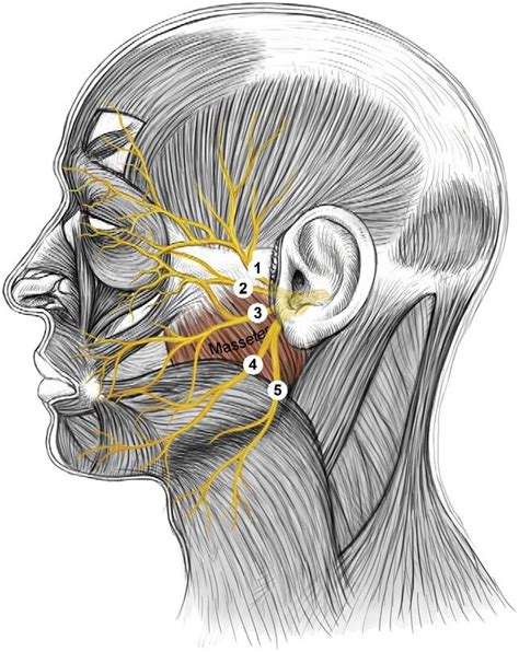 Terminal branches of the facial nerve on the face. (1) temporal branch ...