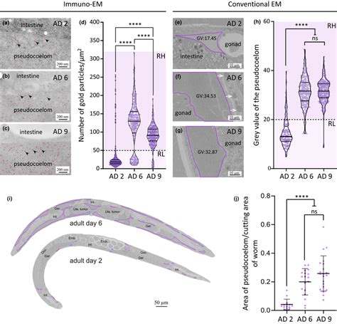 Yolk accumulates in the expanded pseudocoelom in older worms. (a–c)... | Download Scientific Diagram