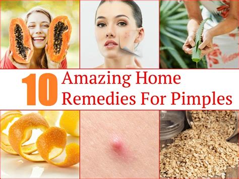 10 Amazing Home Remedies For Pimples - School Of Life