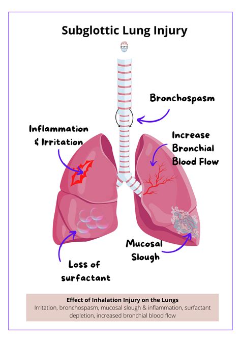 Inhalation Injury