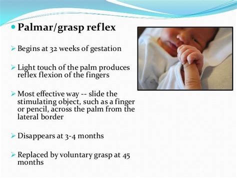 Palmar Grasp Reflex | Newborn congestion, Baby development, Reflexes