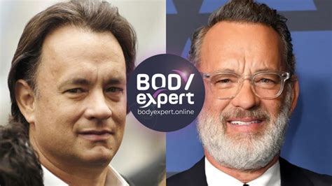 Hair transplant: which celebrity has a hair transplant?