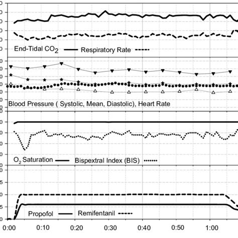 Conscious sedation using propofol and remifentanil TCI. | Download ...